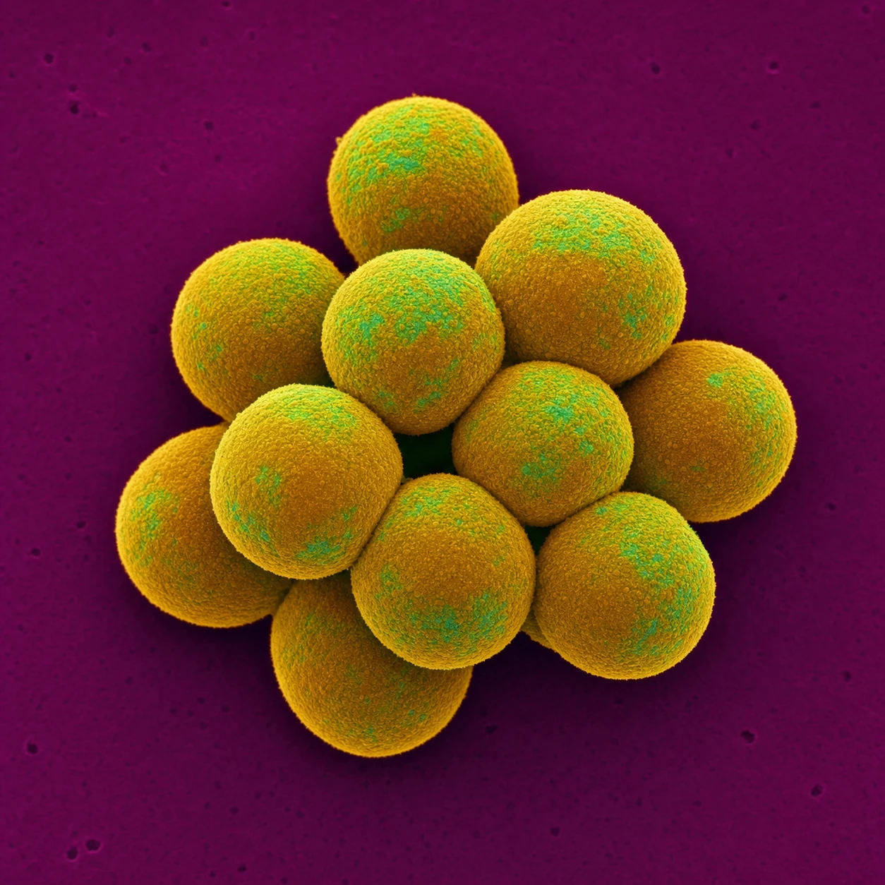 A stylized scanning-electron-microscope-style render of a tight cluster of spherical bacteria against a vivid magenta background.