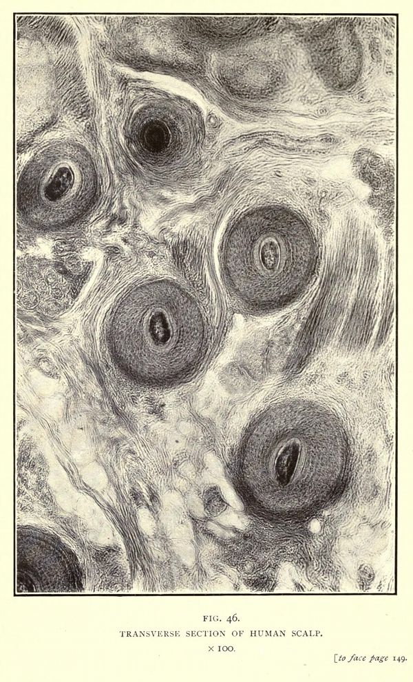 A detailed black and white illustration of a transverse section of human scalp, showing numerous hair follicles embedded in fibrous tissue.