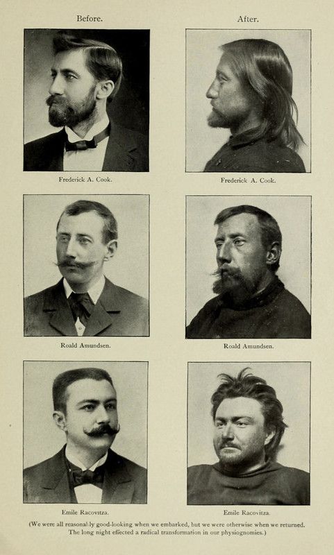 A vintage photograph featuring a grid of six portraits, labeled 'Before' and 'After'. Each row showcases a different individual—Frederick A. Cook, Roald Amundsen, and Emile Racovitz—with a portrait depicting their appearance before and after an expedition.