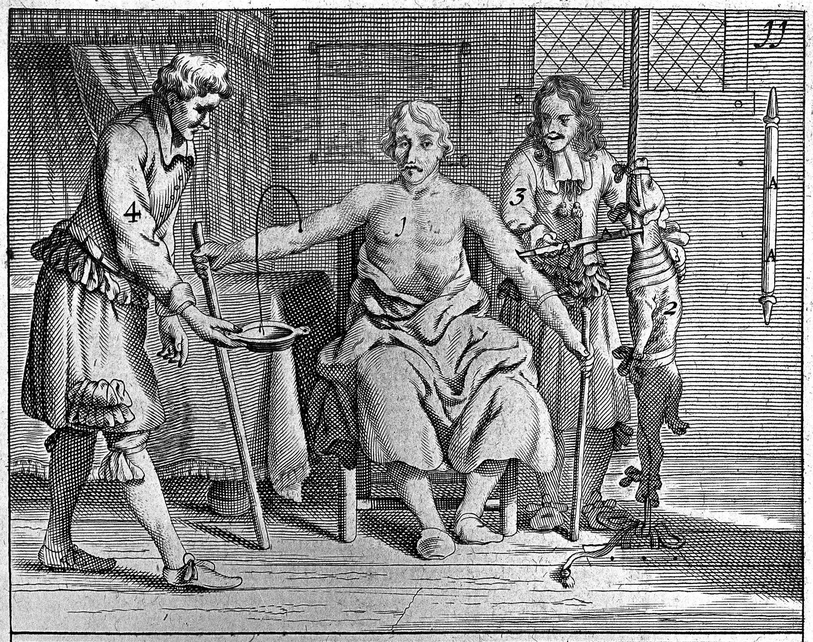 A black and white engraving depicting a scene with three men in a room. The central figure is seated and partially unclothed, while the other two men are attending to him. The scene is labeled with numbers 1-4.