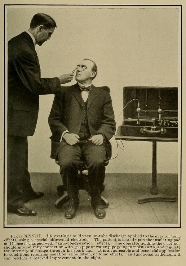 Vintage photograph of a medical procedure involving a vacuum tube and electrode applied to a patient's eyes.