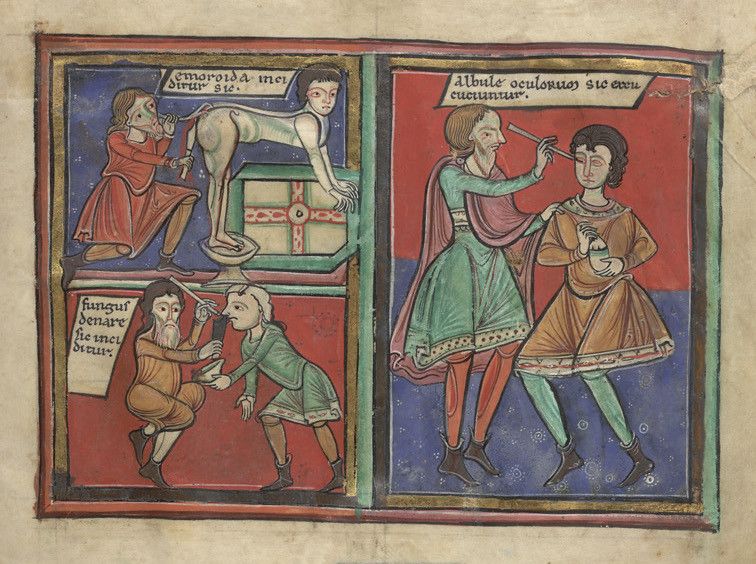 Medieval illustration of medical procedures