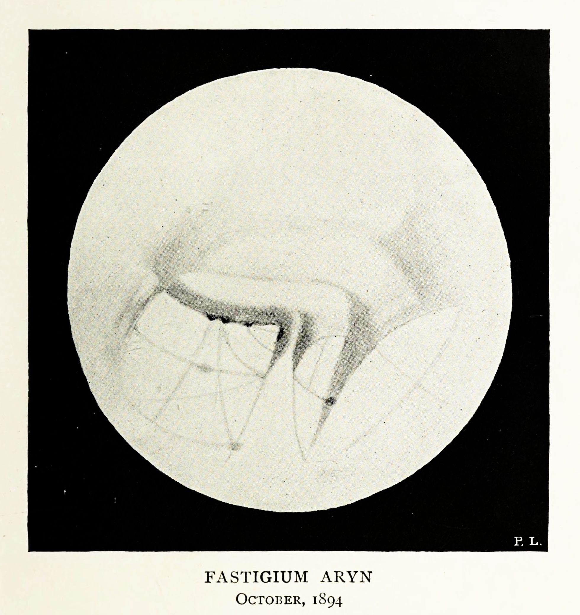A vintage black and white photograph of a microscopic organism, labeled "FASTIGIUM ARYN" and dated "OCTOBER, 1894".