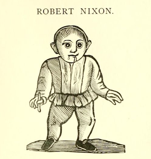 Vintage illustration of Robert Nixon, a person with a medical condition, standing on a platform.