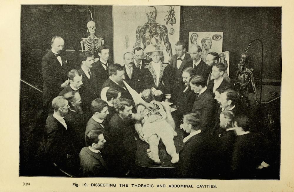 A vintage black and white photograph of a medical anatomy lesson with a group of men dissecting a cadaver in a classroom or laboratory setting.