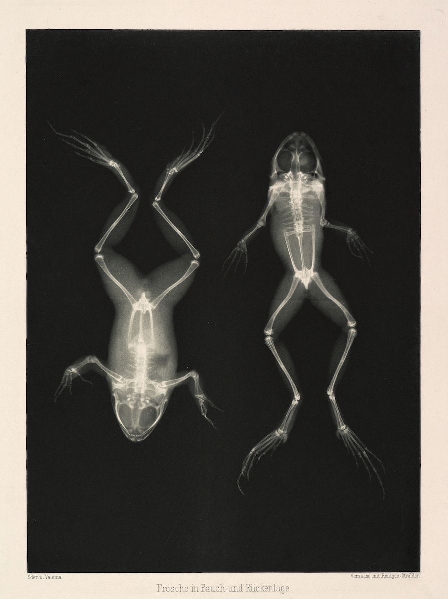Vintage x-ray image of two frogs in ventral and dorsal positions, showing their skeletal structures.