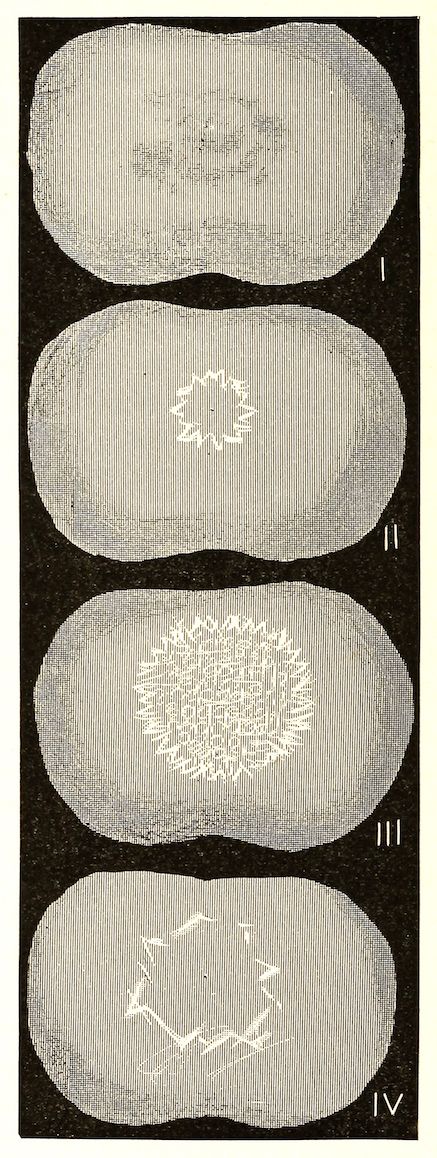 Four stages of cell division, showing the condensation and separation of chromosomes within a cell nucleus.