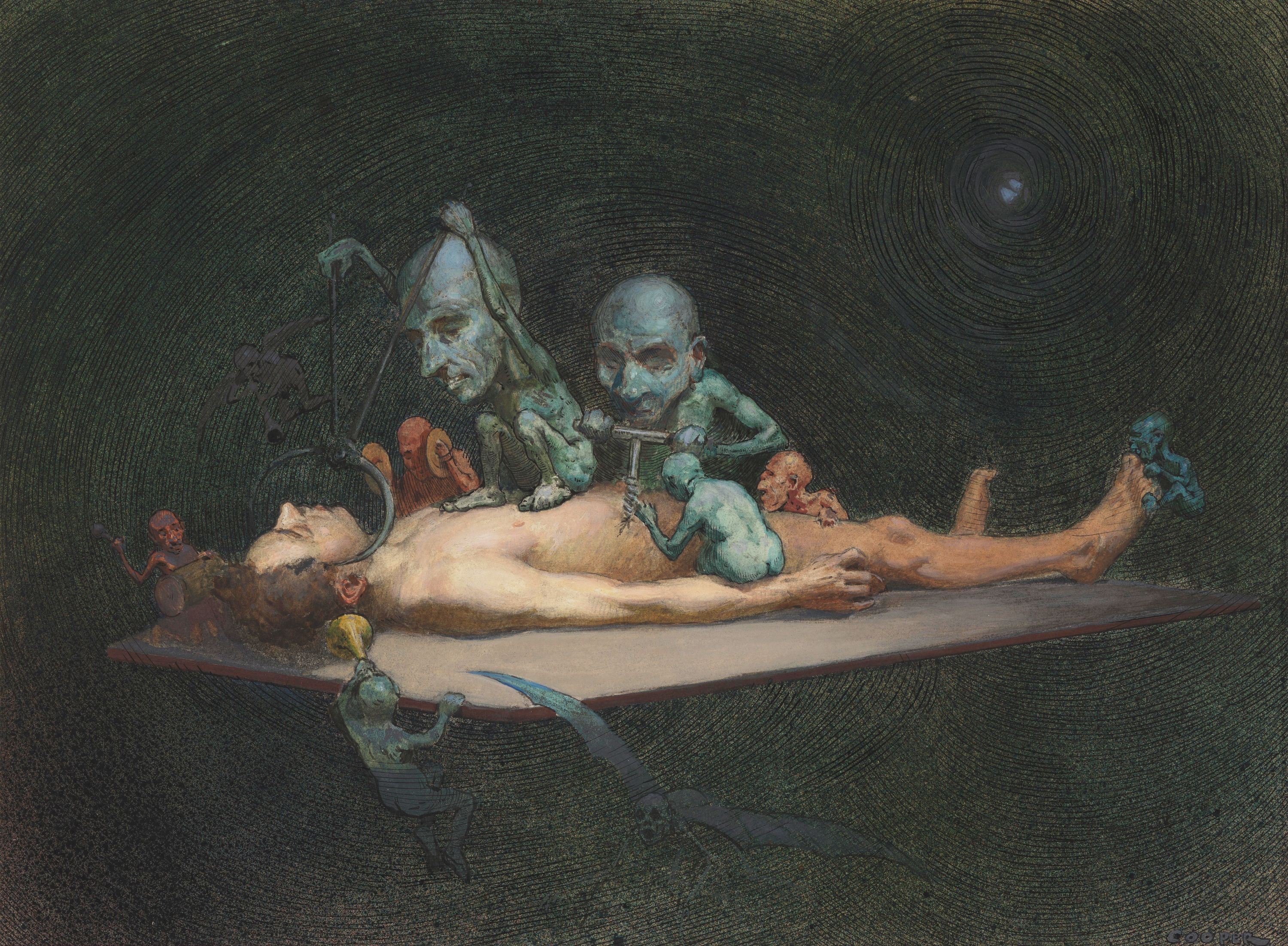 A disturbing image of a nude human figure surrounded by grotesque creatures performing a macabre medical procedure.