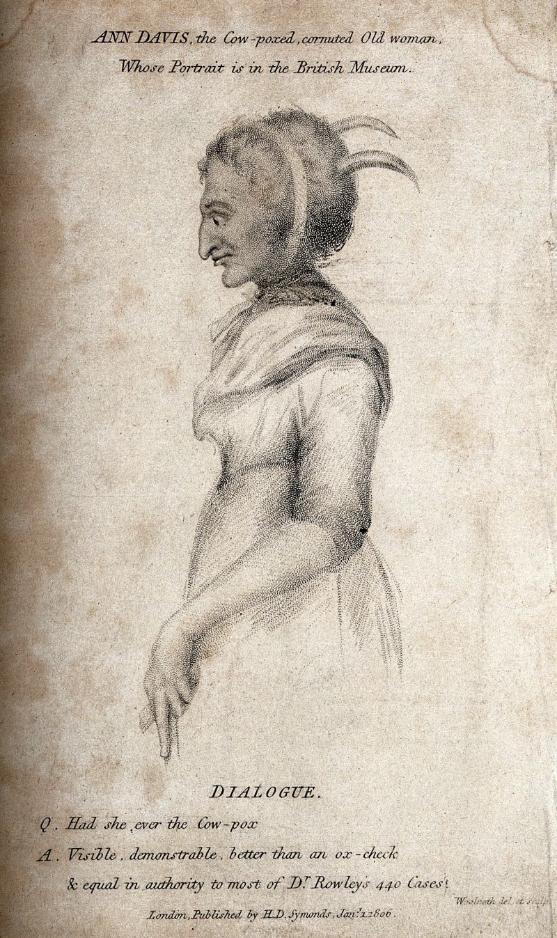A vintage print of Ann Davis, an elderly woman who was vaccinated against smallpox with cowpox. The print is a side profile portrait of her, showing her head, neck, shoulder, and upper arm. Her upper arm is exposed, revealing numerous small spots, which are the marks from the cowpox vaccination. Below the portrait is a dialogue in text form.