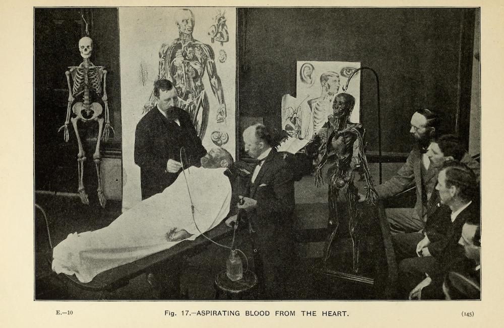 A vintage illustration of a medical procedure, showing a doctor aspirating blood from a patient's heart, with observers and anatomical diagrams in the background.