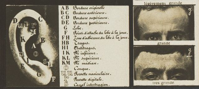 Vintage anatomical illustration of an ear with labeled parts and three portraits of a man with varying ear sizes.