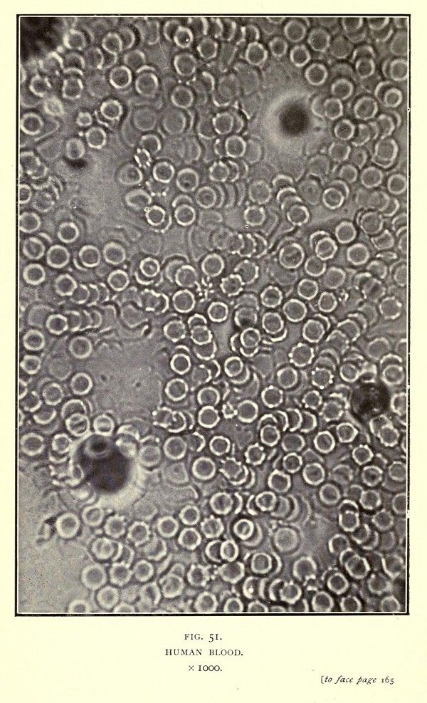 Microscopic view of human blood with red and white blood cells.
