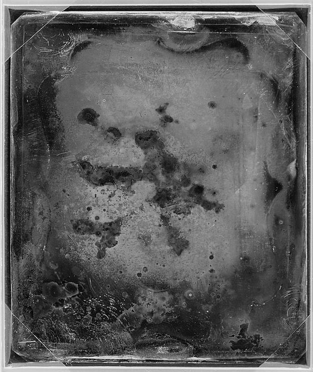 A heavily degraded daguerreotype portrait of a face, showing dark, blotchy areas and various imperfections on the plate.