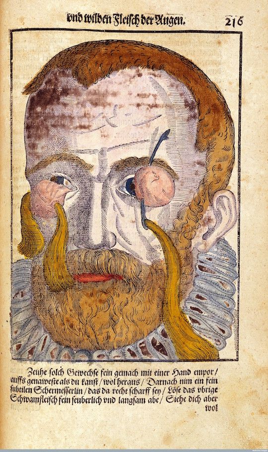 Vintage woodcut illustration of a man with a long beard and sparse hair, with German text below.