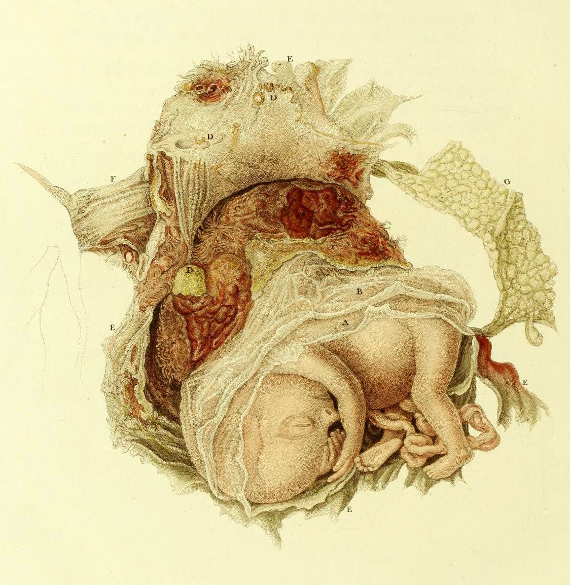 Vintage medical illustration of a fetus in the uterus with labeled anatomical structures.