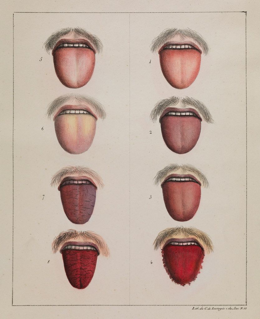 Vintage anatomical illustration of eight different views of a human mouth with the tongue extended, numbered 1 through 8.