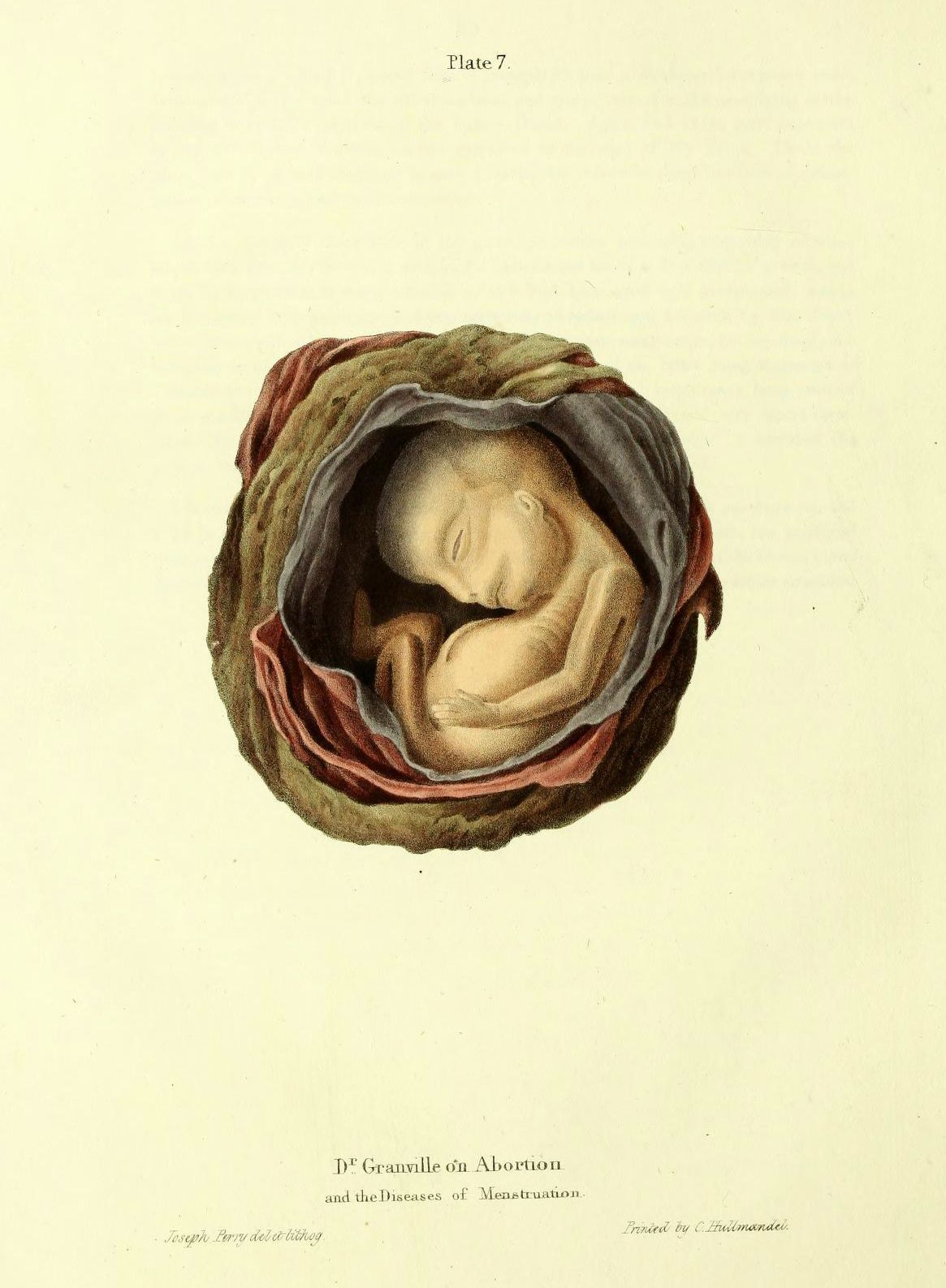 Vintage anatomical illustration of a fetus in a uterus, labeled 'Plate 7' and 'D. Granville on Abortion and the Diseases of Menstruation'.