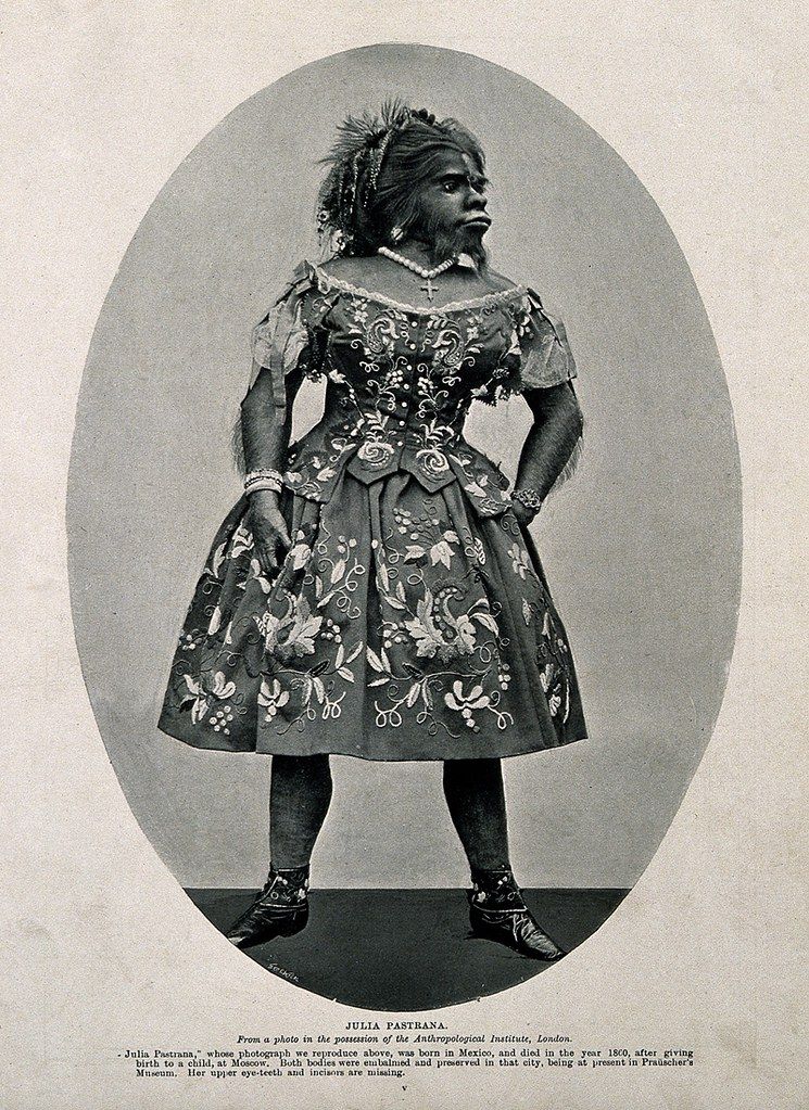 A vintage black and white photograph of Julia Pastrana, a Mexican woman with hypertrichosis, wearing an ornate dress and standing in a full-length portrait.