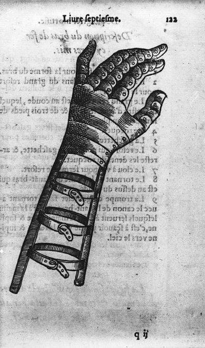 A vintage illustration of a bandaged hand and forearm, surrounded by old text.
