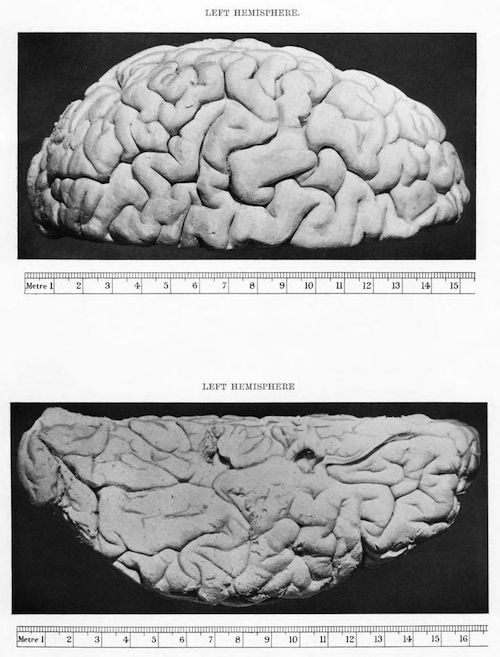 Two views of the left hemisphere of a human brain, with a metric scale for reference.