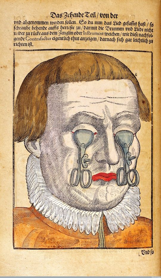 Vintage woodcut illustration of a man with a mechanical instrument attached to his nose and tears in his eyes.