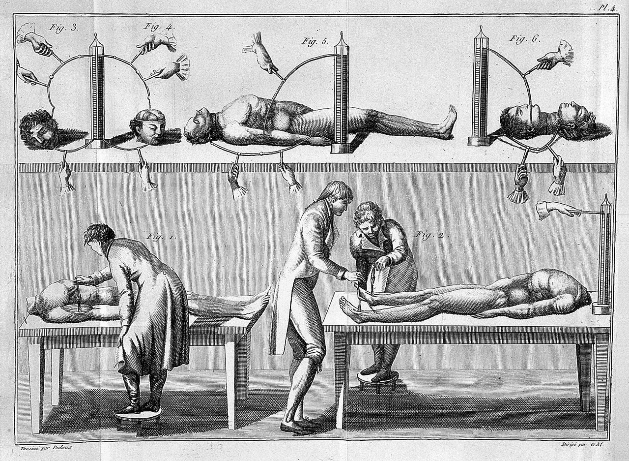 A historical medical illustration depicting anatomical studies involving human bodies, with figures suspended by ropes and dissected on a table.