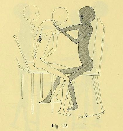Vintage medical illustration of two slender figures seated at a table, one appearing to be examined by the other.