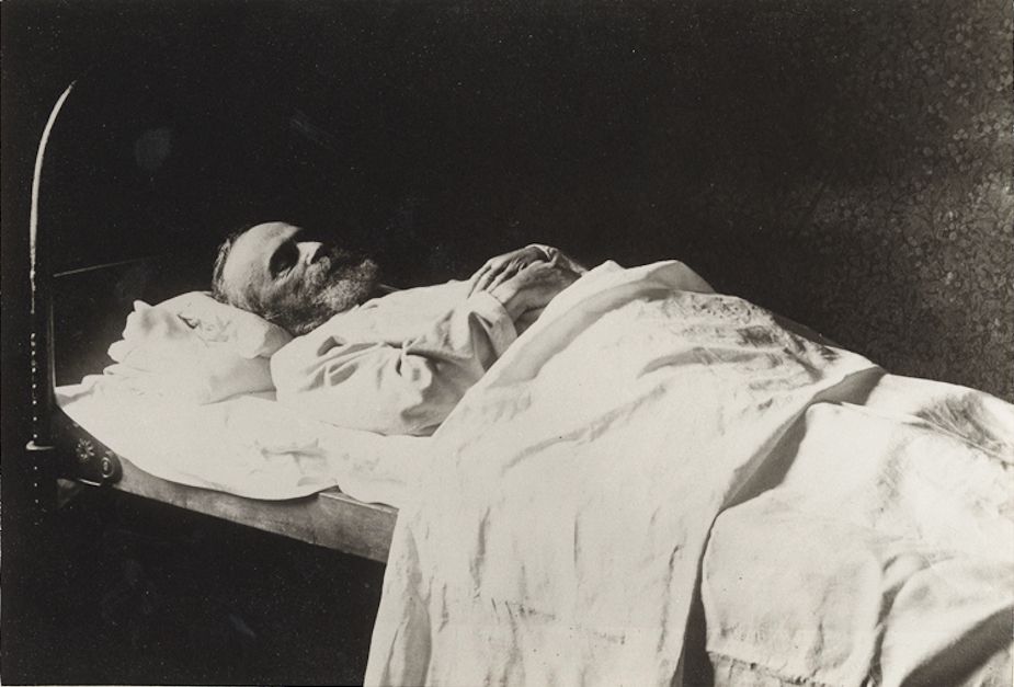 A black and white photograph of a deceased person lying in a bed, covered with a blanket and pillow.