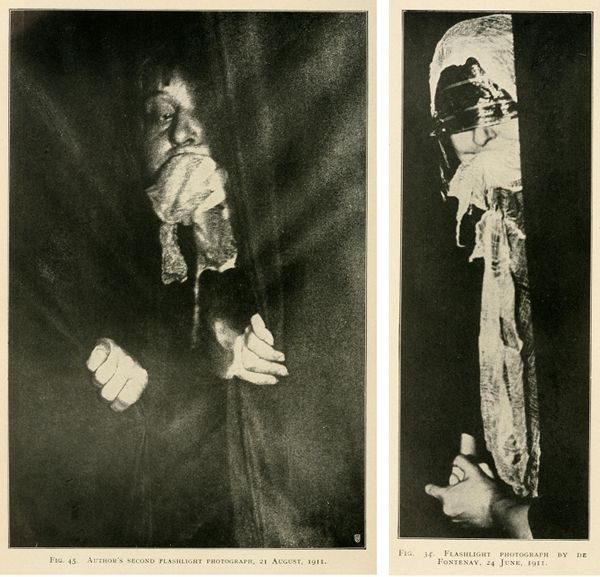 Two black and white photographs from 1911 showing a person heavily bandaged, likely as part of an experiment or demonstration.