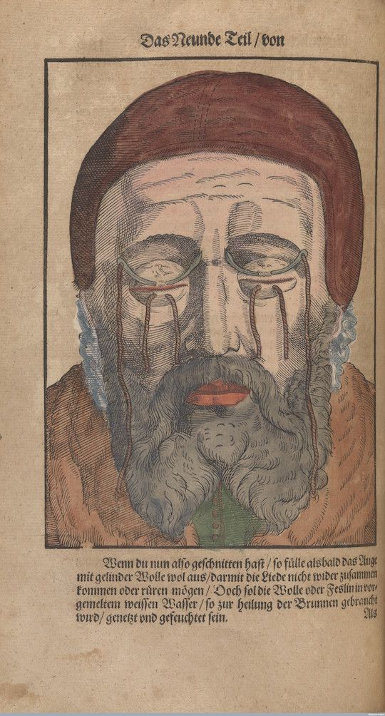 Vintage engraving of a man's head with tears streaming down his face.