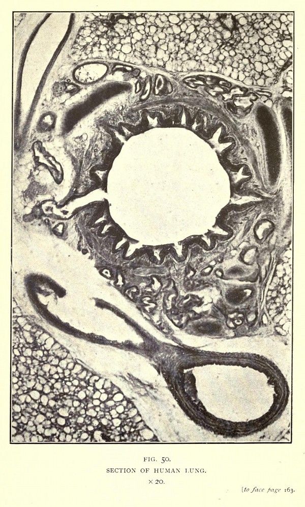 Microscopic image of a section of a human lung, showing a central airway surrounded by dense lung tissue and blood vessels.