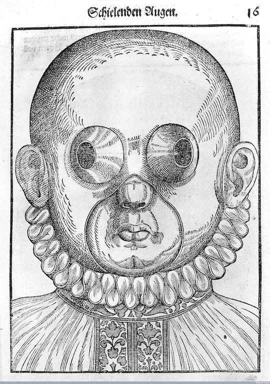 A black and white engraving of a bald head with wide-set eyes, a small nose, and a ruffled collar.