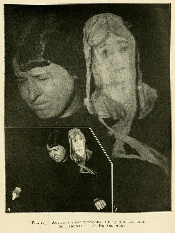 A vintage black and white photograph of a person with a significant facial disfigurement, divided into sections labeled 'Original' and 'Enlargement'.