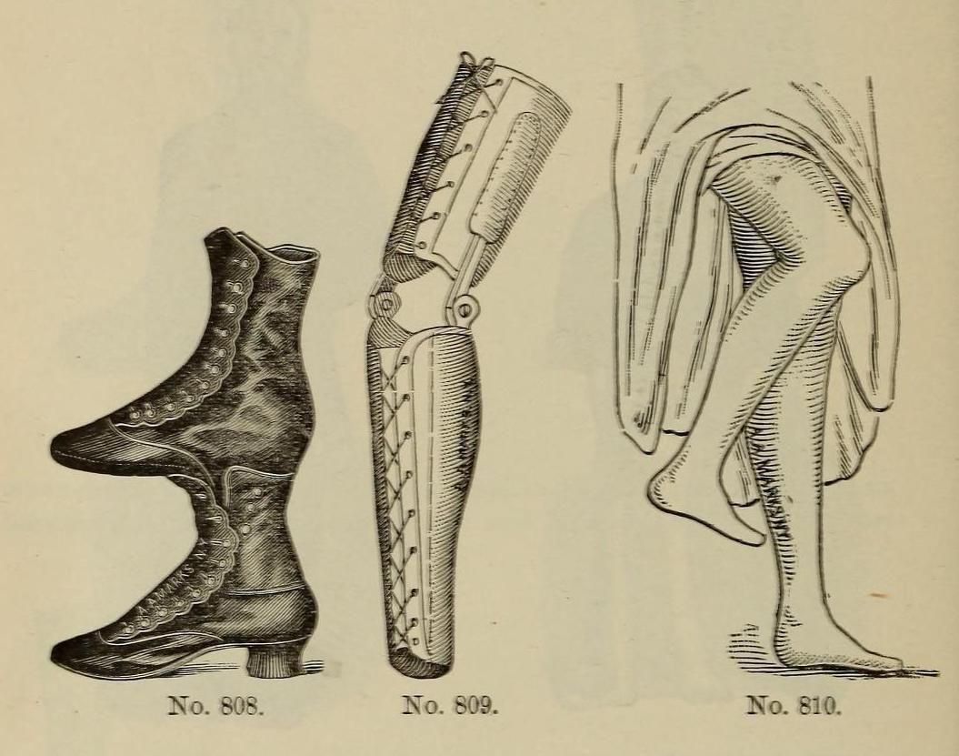 Vintage illustration of three orthopedic devices: a high-buttoned boot, a leg brace, and a foot support.