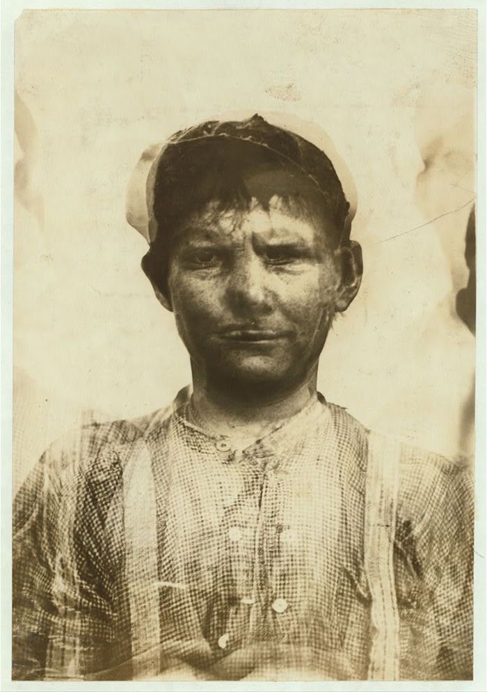 A vintage black and white photograph of a young boy covered in dirt, wearing a cap and patterned shirt.
