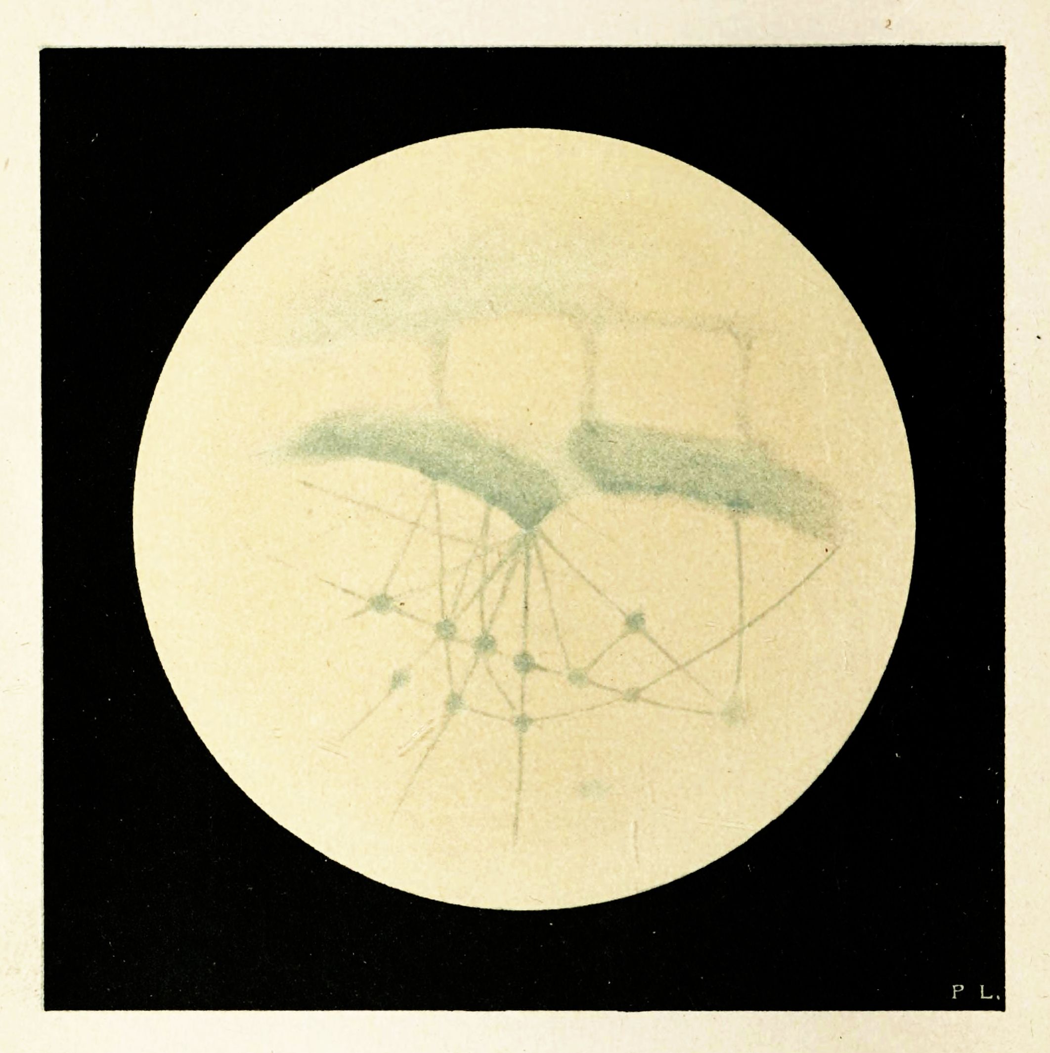 Microscopic view of a cell undergoing cell division, showing chromosomes and spindle fibers.