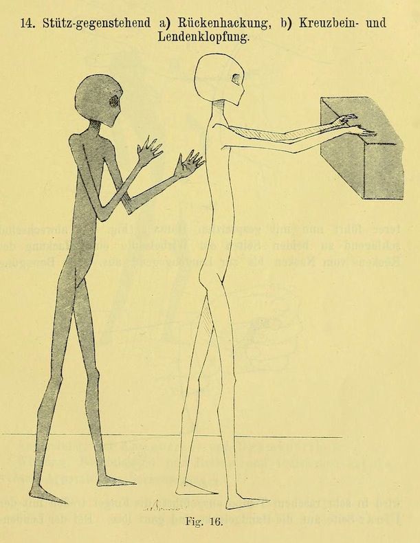 Vintage medical illustration of two skeletal figures and a box.