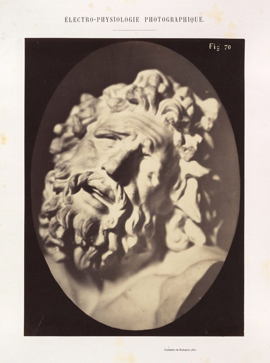 A vintage black and white photograph titled "Electro-Physiologie Photographique" and labeled "Fig. 70". It depicts a portrait of a man's head and shoulders with a full beard and mustache.