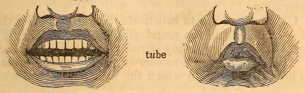 Vintage medical illustration of an open mouth with a tube inserted, showing detailed cross-hatching and anatomical features.