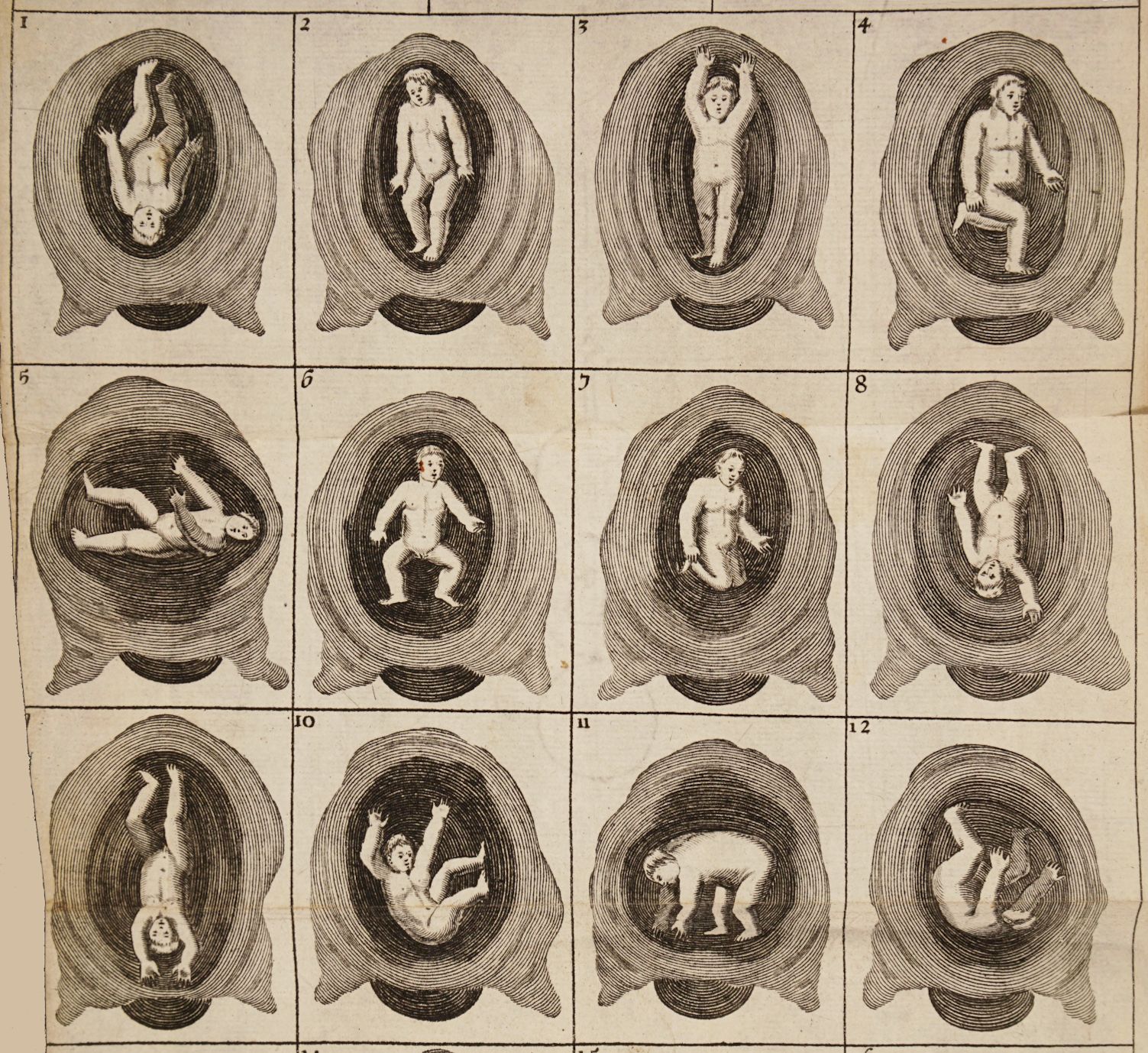 Vintage medical illustration of fetal development in twelve stages within the womb.