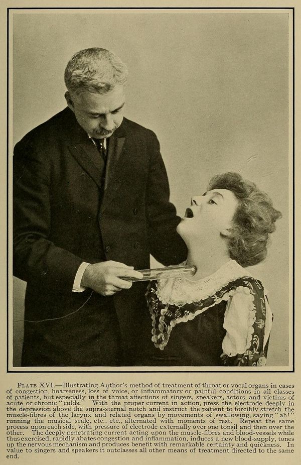 Vintage photograph of a medical procedure being performed on a man's throat with an electrical device.