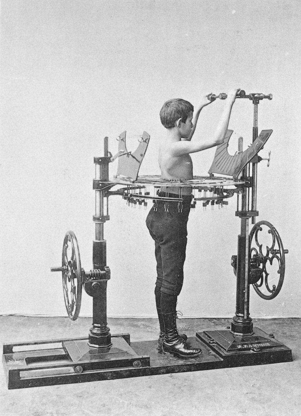 Vintage black and white photograph of a boy in a complex medical device.