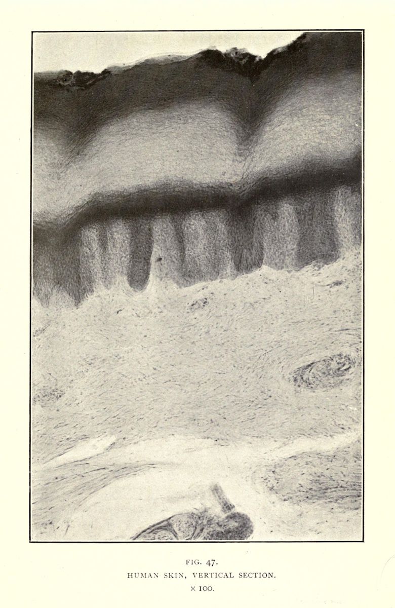 Vintage illustration of a vertical section of human skin, showing the epidermis, dermal papillae, and deeper layers, with text indicating the figure number, subject, and magnification level.