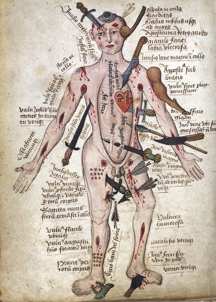 A medieval manuscript illustration of a human body covered in numerous wounds inflicted by various weapons, with detailed Latin labels.