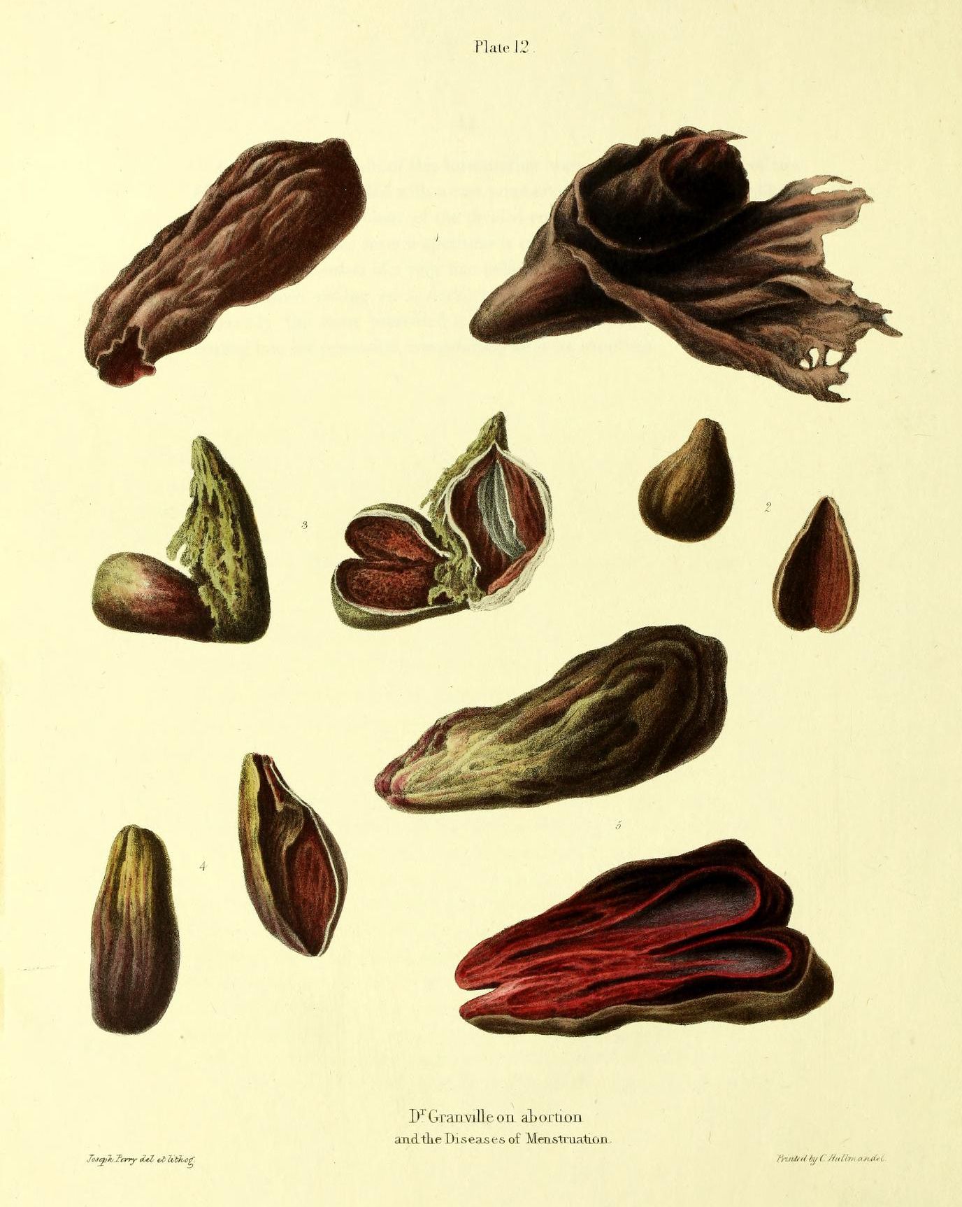 Vintage botanical illustration of plant parts, likely related to medical or reproductive health, with detailed drawings of seed pods, flowers, and leaves in shades of red, burgundy, and green.
