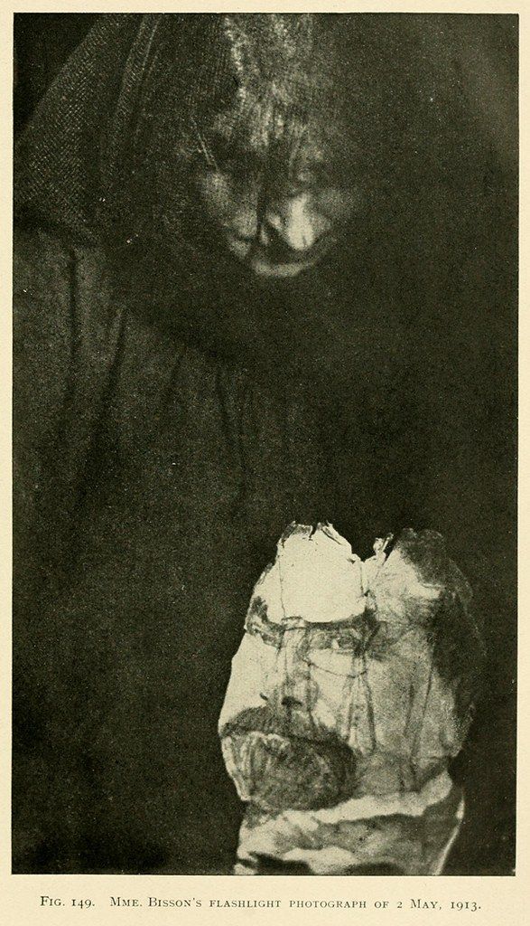 A black and white photograph of a person with a heavily bandaged face, looking downwards. The background is dark and the image has a grainy texture.