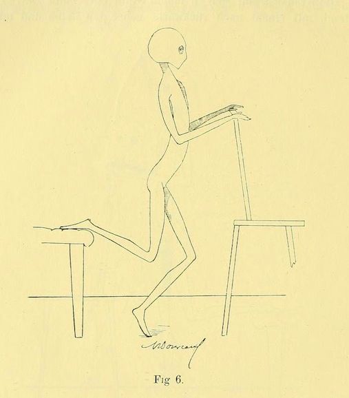 Vintage anatomical drawing of a person standing on a platform, with furniture in the background.