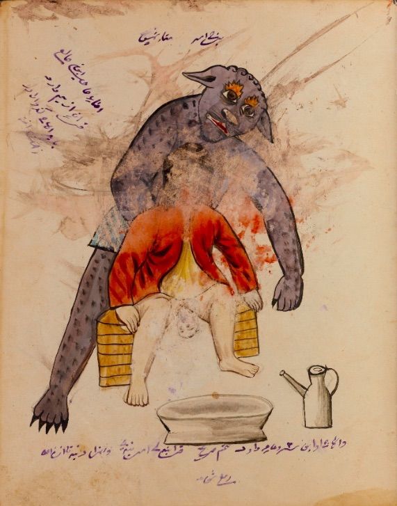 Vintage illustration of a monstrous creature performing a procedure on a seated person, with a basin and pitcher nearby.