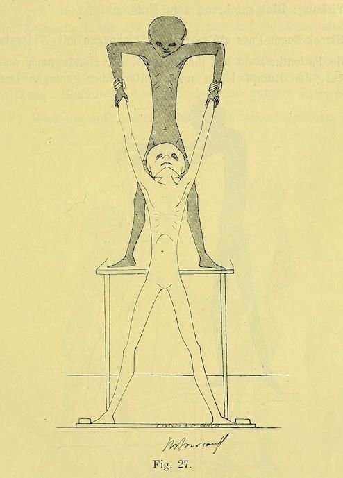 Vintage illustration of an alien-like figure holding a person's arms above their head while they lie on a table.