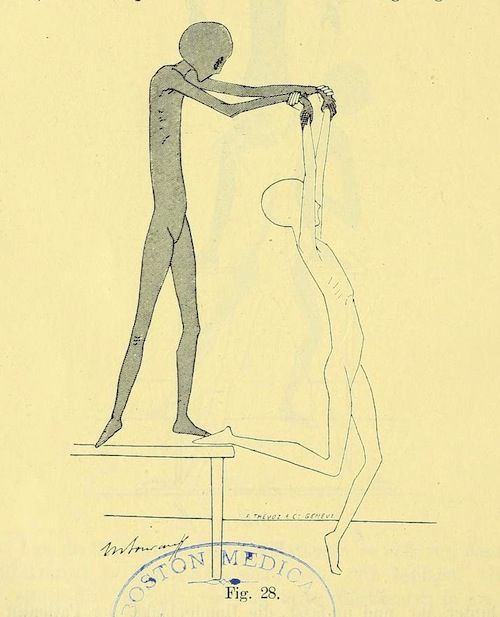 Vintage medical illustration of an alien-like figure examining a human body outline on a table.